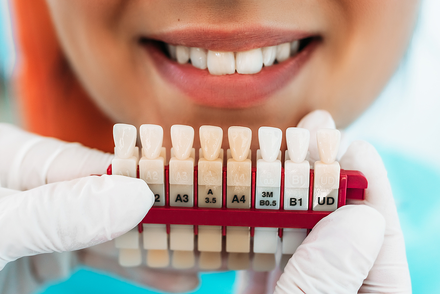 Transform Your Smile with Cosmetic Dentistry in Lehi, UT